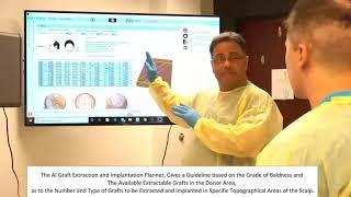 HARRTS X-2 Robotic Hair Transplant System | Graft Extraction Calculator Demonstration