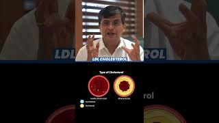 Why Your LDL Cholesterol Deserves Attention | Low-Density Lipoprotein | Chellaram Hospital