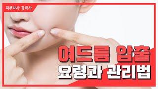 [피부박사강박사]여드름 짜는 방법 알고가세요.