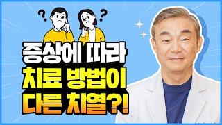 치열 증상에 따라서 치료 방법이 다르다구요?!