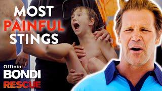 Worst Blue Bottle Jellyfish Stings on Bondi Rescue