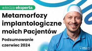 Prawdziwe Historie Moich Pacjentów - Czerwiec 2024