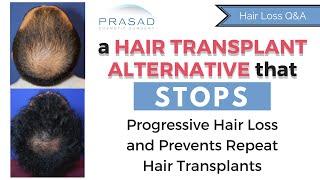 Alternative to Hair Transplantation and Finasteride (Propecia) that Stops Hair Loss