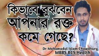 কিভাবে বুঝবেন আপনার শরীরে রক্তশূন্যতা আছে?Symptoms of anaemia.Part-2