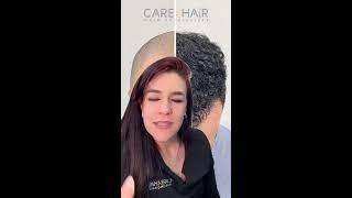 Care4Hair Transplante Capilar - Consulta Gratis