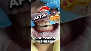 This Smile Hack Will Leave You Speechless! 