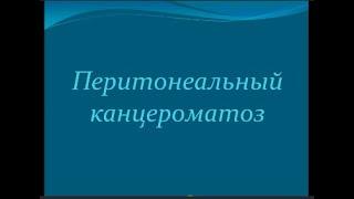 Канцероматоз брыжейки и сальника/Canceromatosis of the mesentery and epiploon