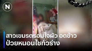 สาวเขมรตรอมใจผัว อดข้าวจนป่วยหนอนไชทั่วร่าง | เนชั่นทันข่าวค่ำ | NationTV22