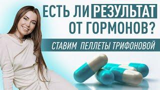 Пеллеты. Есть ли результат через месяц? Работают ли гормоны?