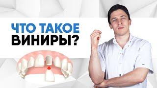 Что такое виниры?