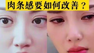 【韩国整形】双眼皮之后的肉条感要怎么解决？