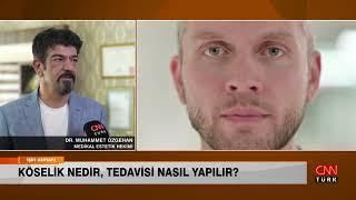 İŞİN UZMANI/ KÖSELİK NEDİR, TEDAVİSİ NASIL YAPILIR? / DR. MUHAMMET ÖZGEHAN (22 HAZİRAN 2023)