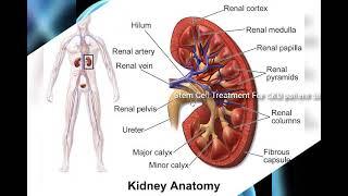 Stem Cell Therapy for Chronic Kidney Diseases | 56 Yrs old Male Patient from Goa,India on Dialysis.