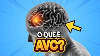 O que é AVC?