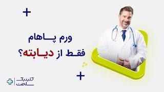 ورم پا فقط از دیابته