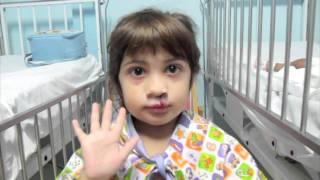 Changing faces with a smile - Operation Smile (Original ) #talita