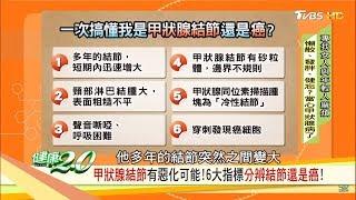 脖子腫腫的、聲音變燒聲？當心甲狀腺出問題！6大指標分辨結節還是癌！健康2.0