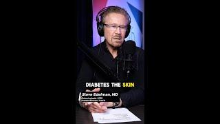 How is dry & itchy skin relation to diabetes? Ep78 Ft. Dr. E