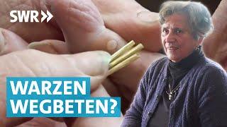 Warzen entfernen – Was hilft wirklich?