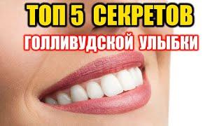 ТОП 5 секретов голливудской улыбки | Голливудская улыбка