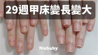 Nail shrinkage - corrected into slender manicure, biting nails Nail short and wide to become a nail