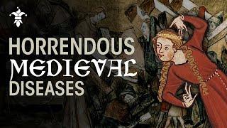 7 Most GRUESOME Medieval Diseases & Their Cures (or Lack of)...