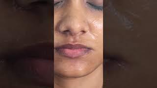 உதட்டில் உள்ள கருமை நீக்க எளிய வழி.#lippigmentation#facecupping#hijama#cuppingtheraphy#halinacupping