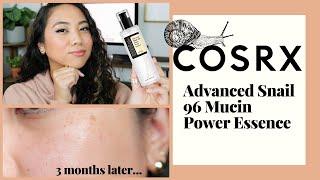 COSRX SNAIL MUCIN ESSENCE: MUST WATCH BEFORE YOU BUY | REVIEW + DEMO ON COMBINATION SKIN