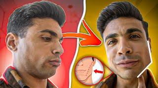 ازاي يبقى عندك فك قوي - Jawline tips