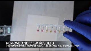 youPCR Gender Detection Protocol