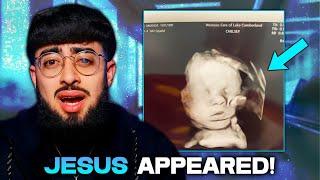 MIRACLE: Hand of God CAUGHT On Baby's Ultrasound!