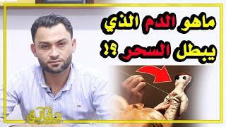 ماهو الدم الذي يبطل السحر⁉️