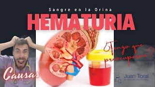 Tengo sangre en la orina ⁉️Qué me está pasando⁉️  HEMATURIA: causas y tratamiento