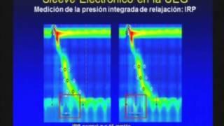 Manometría esofágica de alta resolución  ¿Cuál es la ventaja? - Luis Fernando Pineda, MD