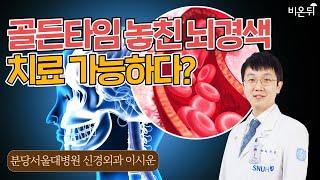 골든타임 놓친 뇌경색, 새로운 치료법이 나왔습니다(분당서울대병원 신경외과 이시운)