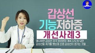 [친절한양약사] 갑상선 기능 저하증 개선사례3 #자기면역질환 #갑상선기능저하증  갑상선 질환은 영양치료로 치료가 가능합니다.