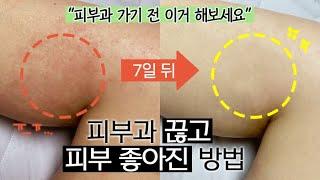 수천만원 쓰고 깨달은 ‘피부 좋아지는 법’드디어 찾아낸 꿀팁.. (NO광고)