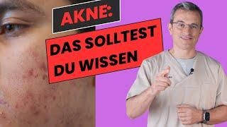 Umfassender Ratgeber zur Akne-Behandlung: Tipps & Therapien von Dr. Kasten #akne #aknebehandlung