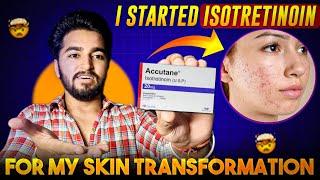 Isotretinoin for Skin Transformation | Accutane for Skin Transformation