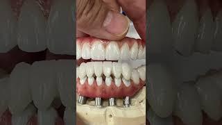 World class prosthetic