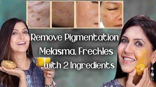 Remove Pigmentation Melasma Freckles with 2 Ingredients/See Results In 1 Week - Ghazal Siddique