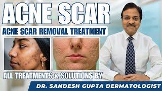 Acne Scars। Effective Treatment Solutions By Dermatologist #acnescarremoval