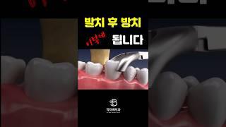 임플란트 뼈이식  #부산임플란트치과 #잇몸전문의
