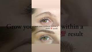 Grow your eyebrows  results easy method |vitamin E  #shorts #shortvideo #beautyessentials