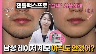 남자 수염 제모는 젠틀맥스프로! 통증, 효과, 부작용, 시술간격 모두 알려드립니다.