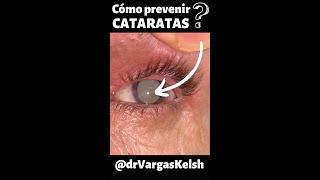 PREVENCIÓN de CATARATAS