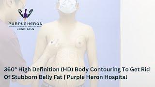 360° High Definition (HD) Body Contouring To Get Rid Of Stubborn Belly Fat | Purple Heron Hospital