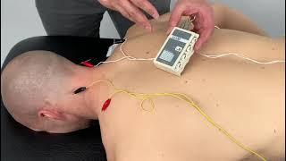 Electro Acupuncture for the Traps