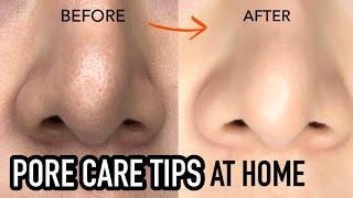 How to treat Large PORES at home | Pore Care Routine and Tips