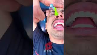 Amazing Video How a Medical Balloon Can Change Everyt ‼️